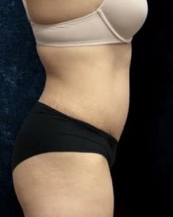 After thumbnail