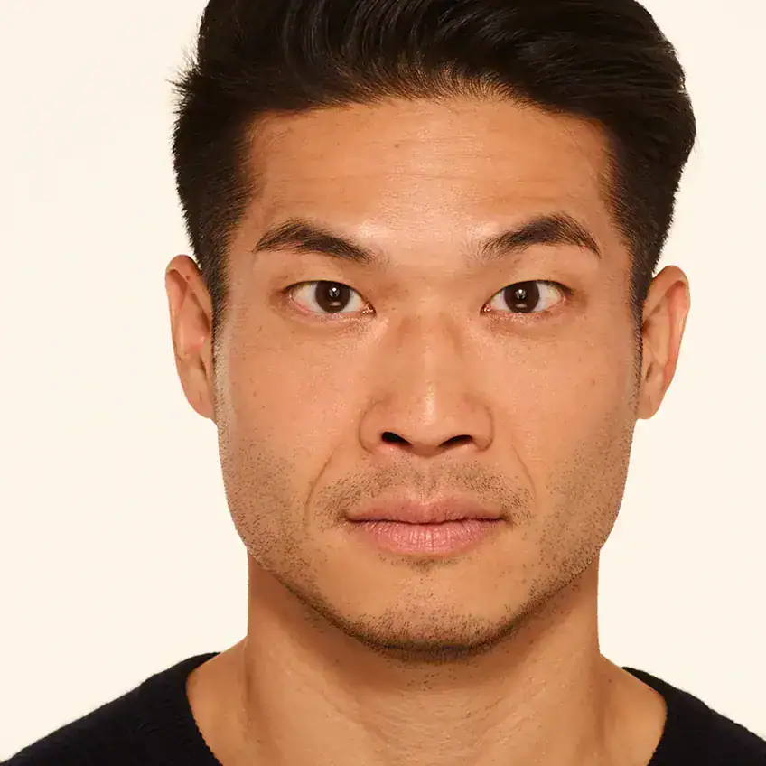 Front-view after Botox treatment of Asian man with smooth forehead.