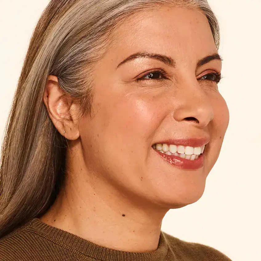Right-view after Botox treatment of woman with smoother skin at the crease of her eyes.