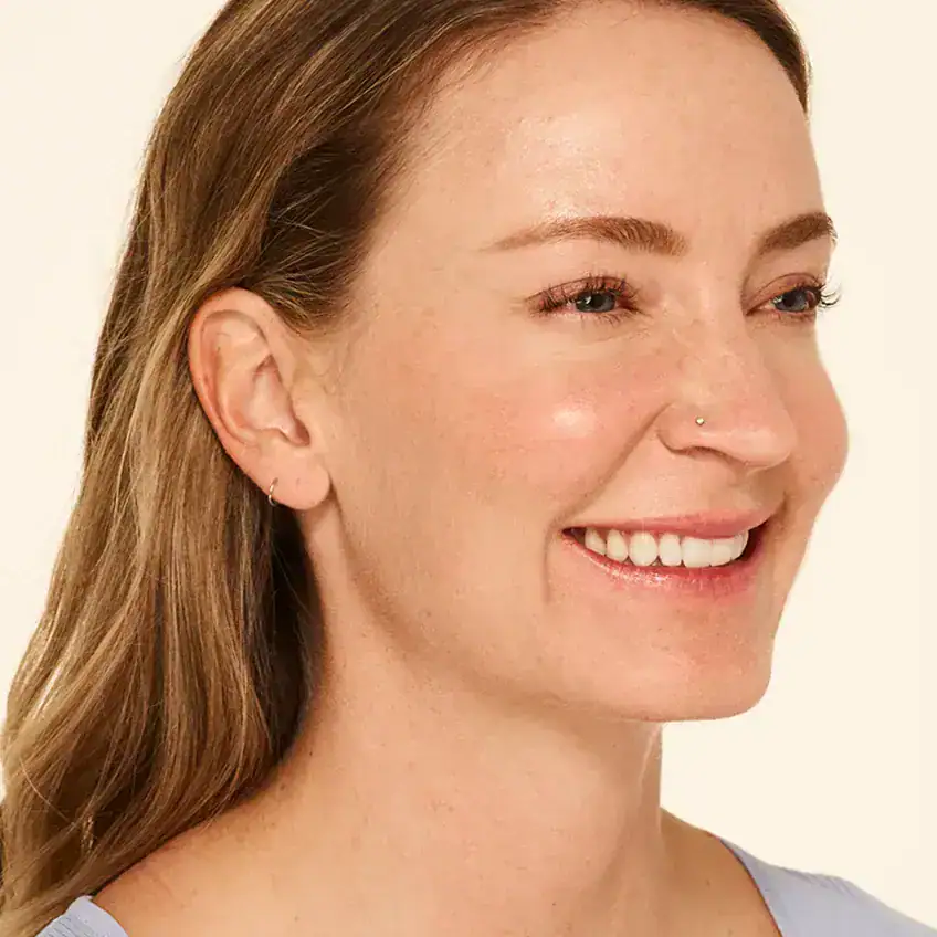 Right-view after Botox treatment of woman with very smooth skin at the crease of her eyes.