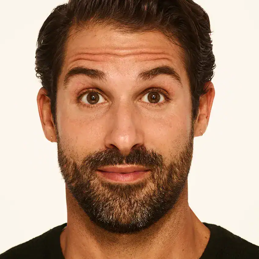 Front-view before Botox treatment of man with deep forehead lines.