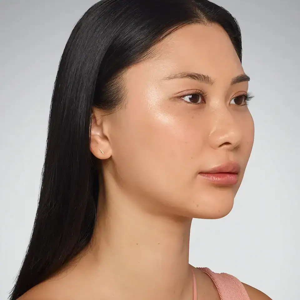 Right-view after Juvederm Ultra treatment of Asian woman with fuller, plumper lips.