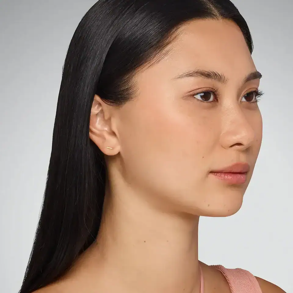 Right-view before Juvederm Ultra treatment of Asian woman with thinner lips.