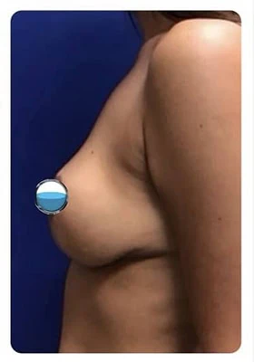 After thumbnail
