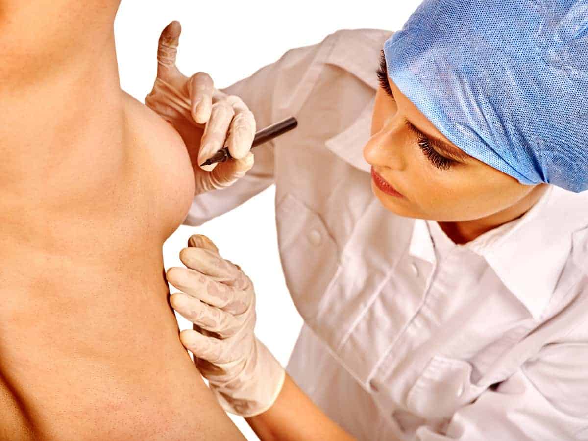 A surgeon marking a woman's breast for surgery