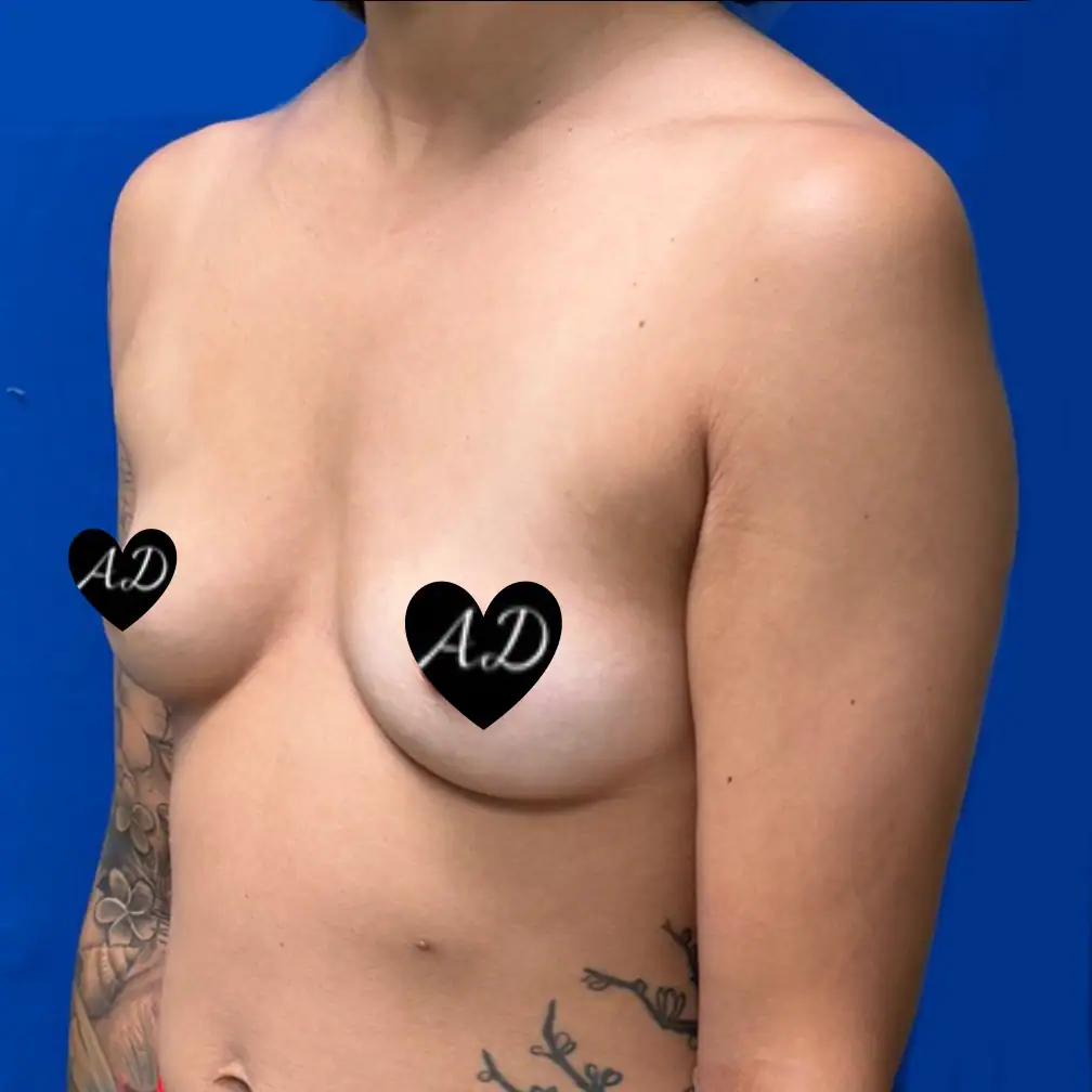 Before thumbnail