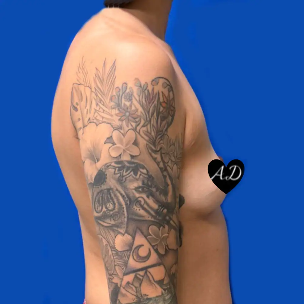 Before thumbnail