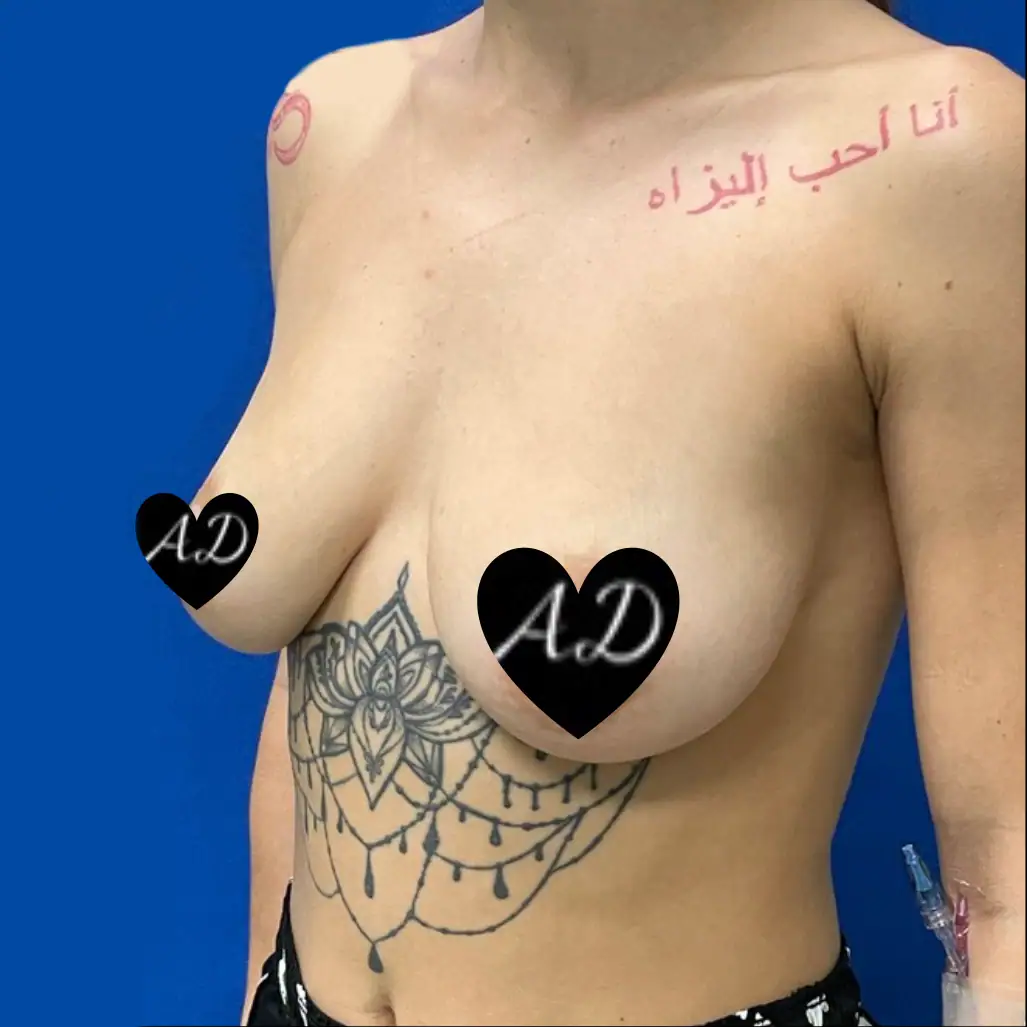 Before thumbnail