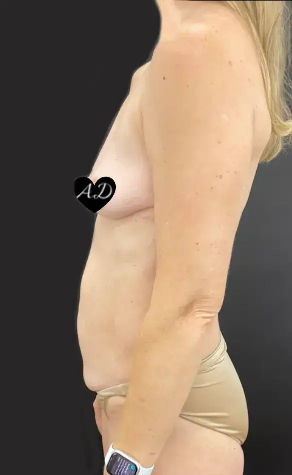 Before thumbnail