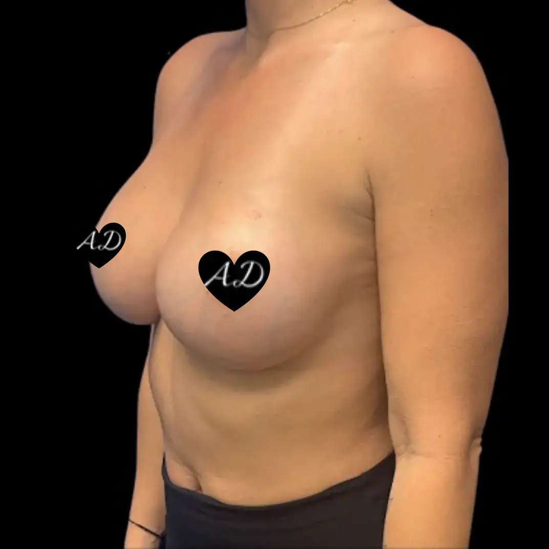 After thumbnail